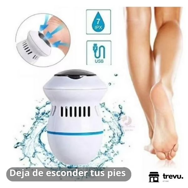 Removedor Callos - NovaPiel®