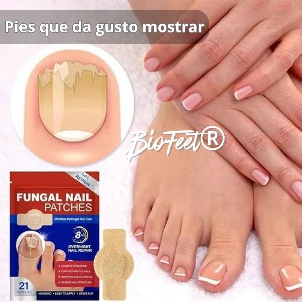 Parche Anti Hongos Uñas - BioFeet®