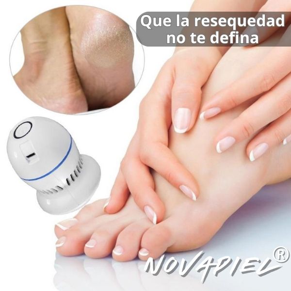 Removedor Callos - NovaPiel®